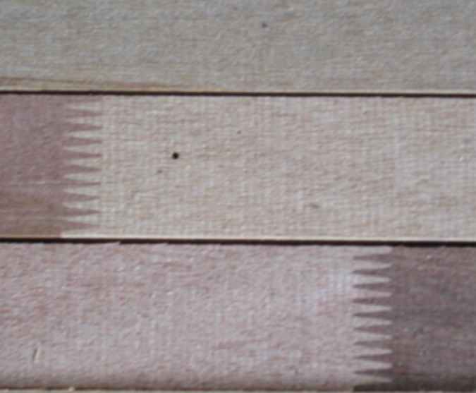 Finger Joint